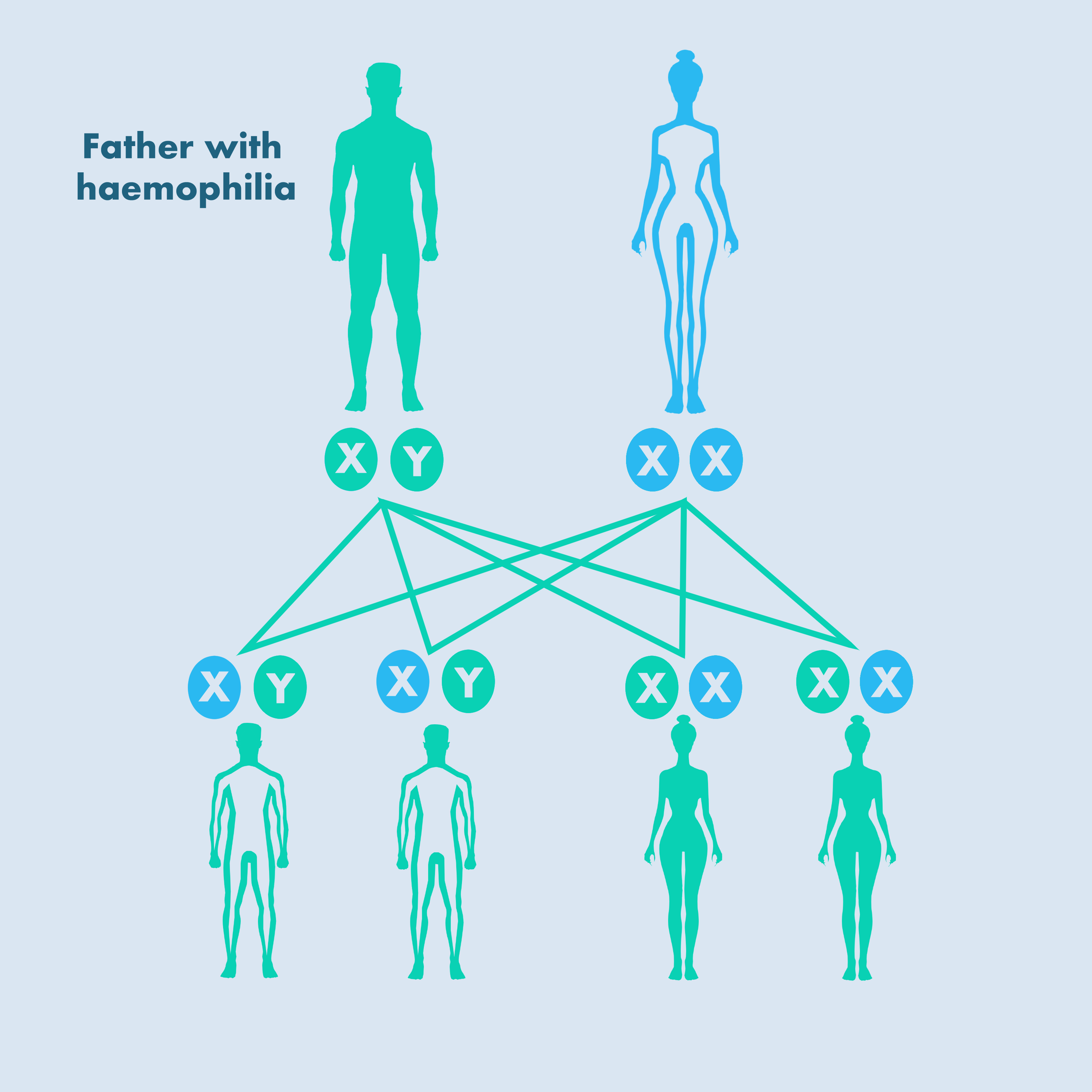 Hemophilia without prophylaxis: Assessment of joint range of